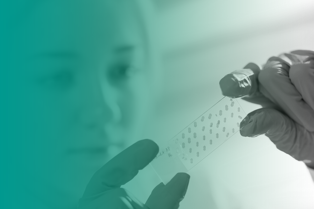 A lab worker holds up and looks at a microscope slide as part of their pathology work.