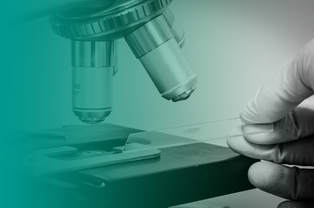 A close-up of a microscope in a pathology lab being used to look at slide as part of an STI screening.